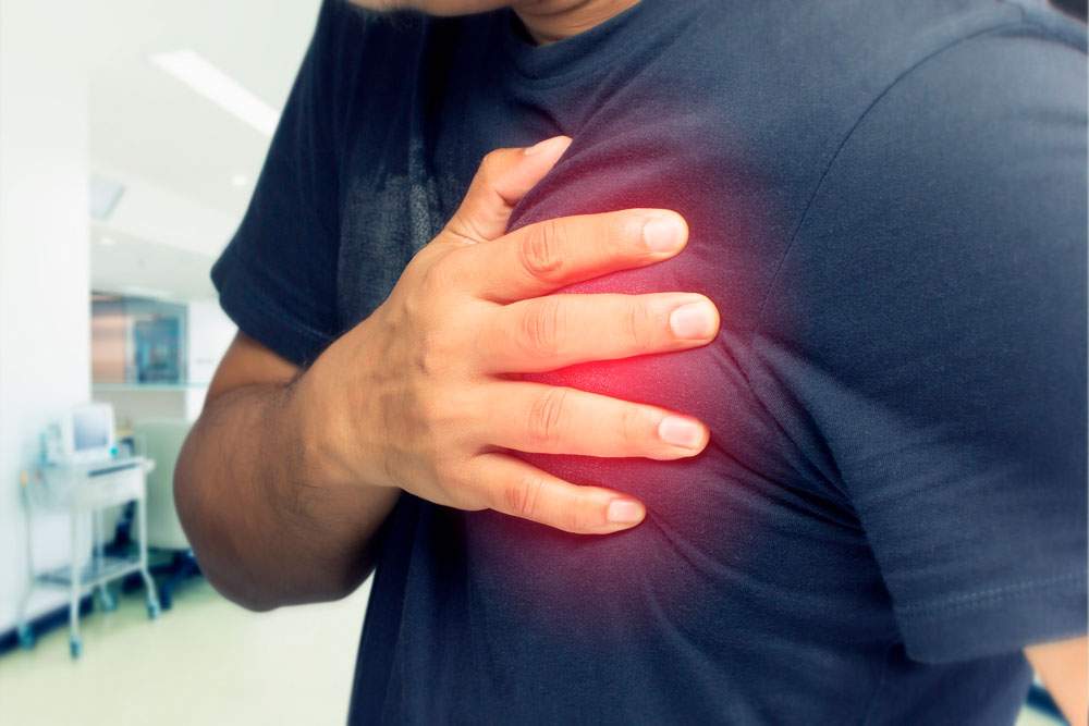 paro cardíaco en un hombre